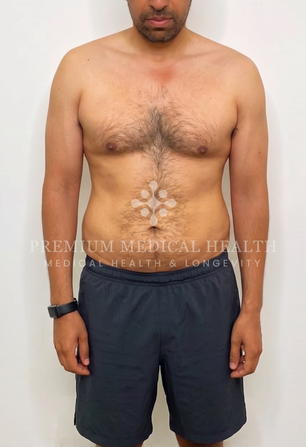 Imran, before