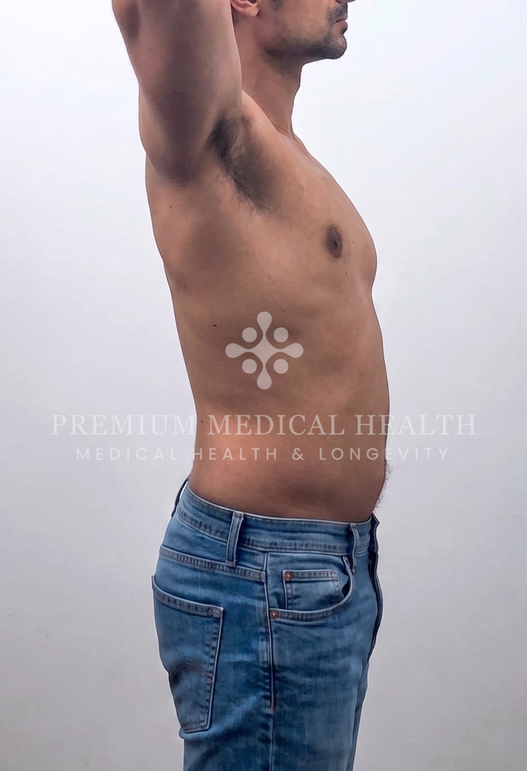 Abdullah, lateral baseline