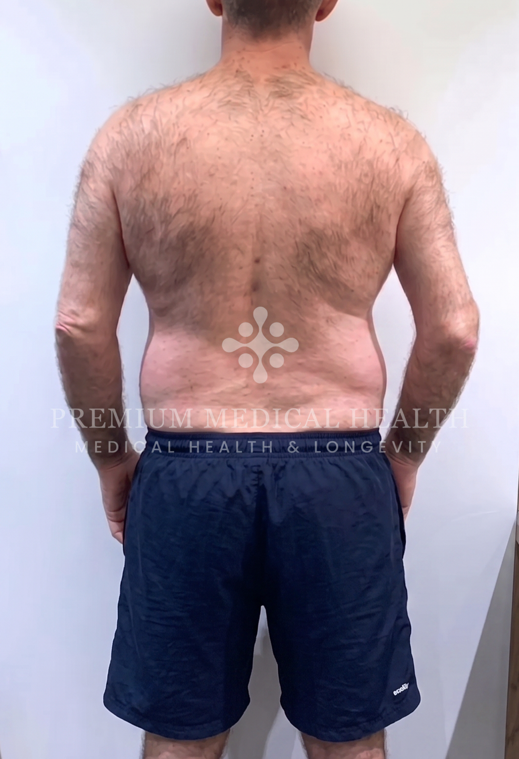 Alexandre, before