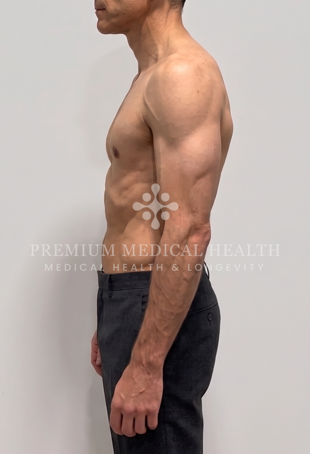 Abed, lateral post-protocol
