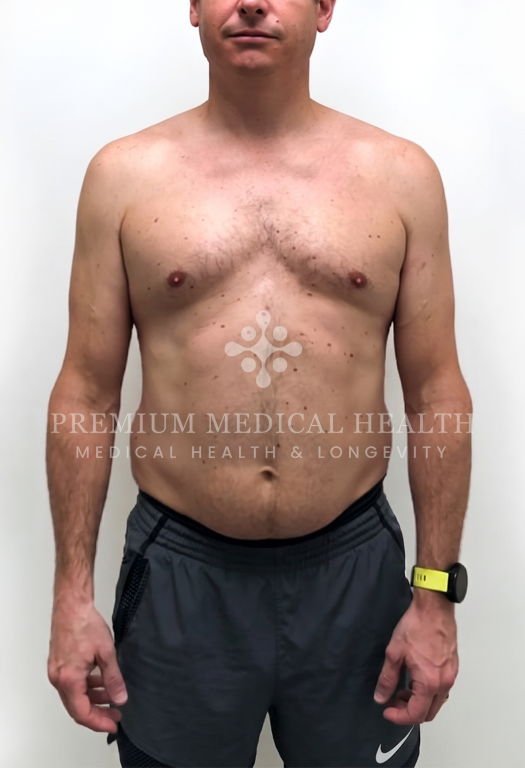 Mark, baseline portrait