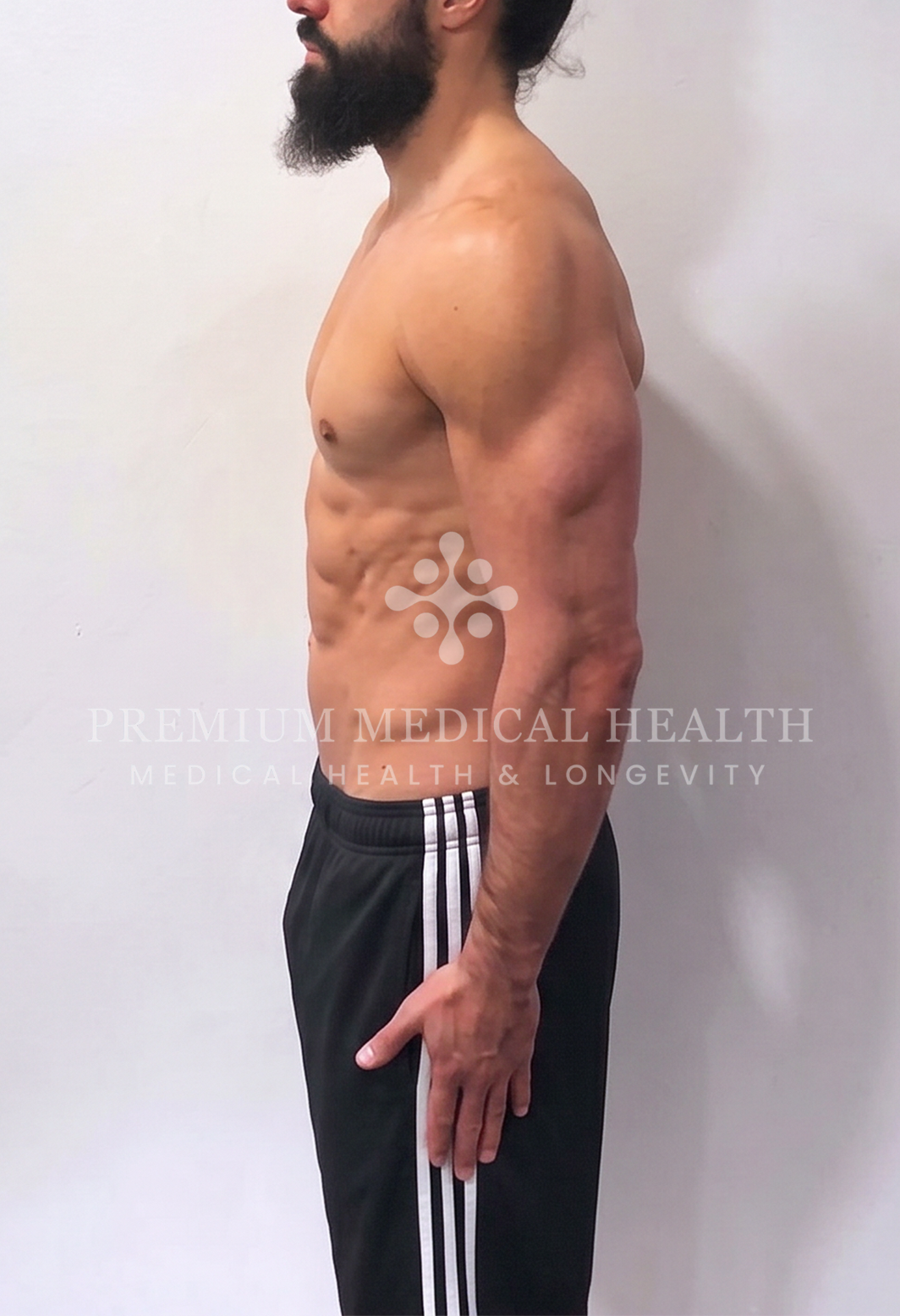 Ayman, lateral post-protocol
