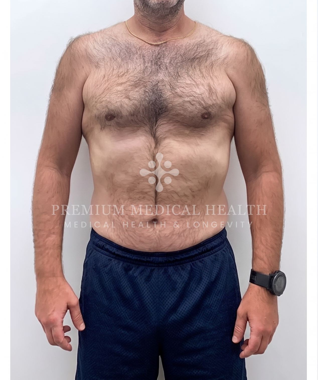 Abed Itani, before