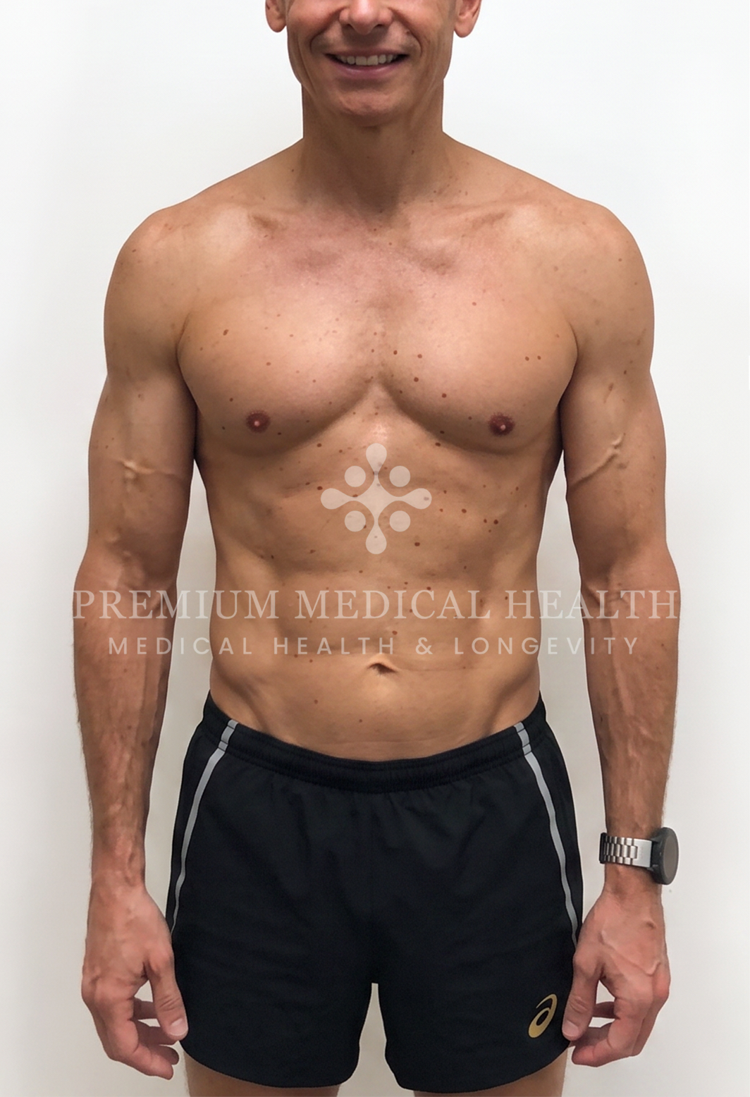 Mark, Crohn’s Disease Management & Metabolic Remodeling
