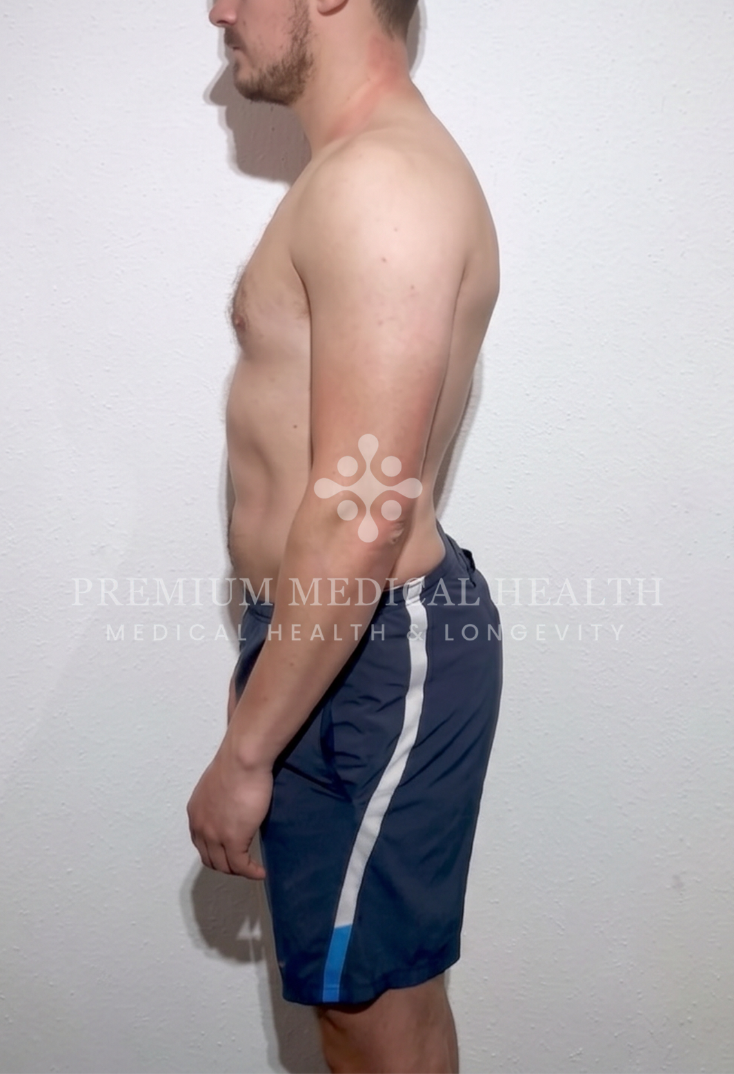 Boulos, lateral baseline